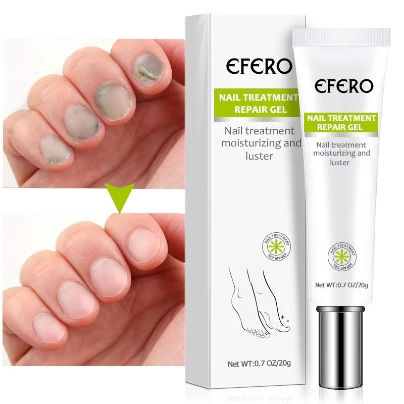 Crema reparadora de uñas